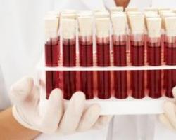 Vai asinsgrupu diēta darbojas atbilstoši asinsgrupai?